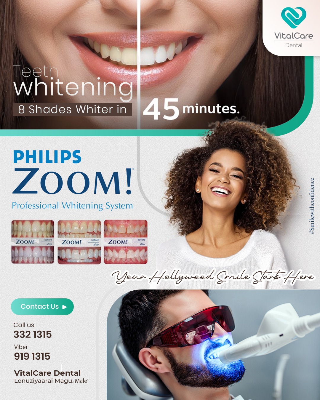 VitalCare professional teeth whitening service